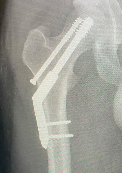 Tame Impala en México: ¿Se cancela concierto? Kevin Parker se fracturó la cadera