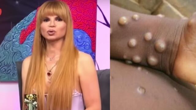 Mhoni Vidente habla de la viruela del mono