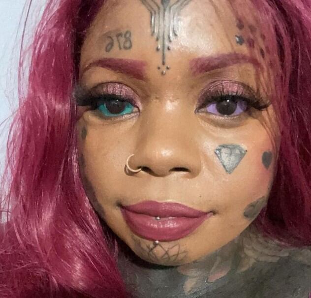 Mujer con problema en sus ojos