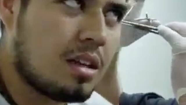 Un joven se desmayó al momento que le hacen una perforación