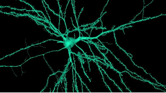 Mapa 3D del interior del cerebro humano