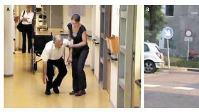 Una terapia económica que beneficia a los pacientes con Parkinson.